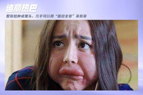 内地龅牙男演员,笑对人生，演绎独特魅力